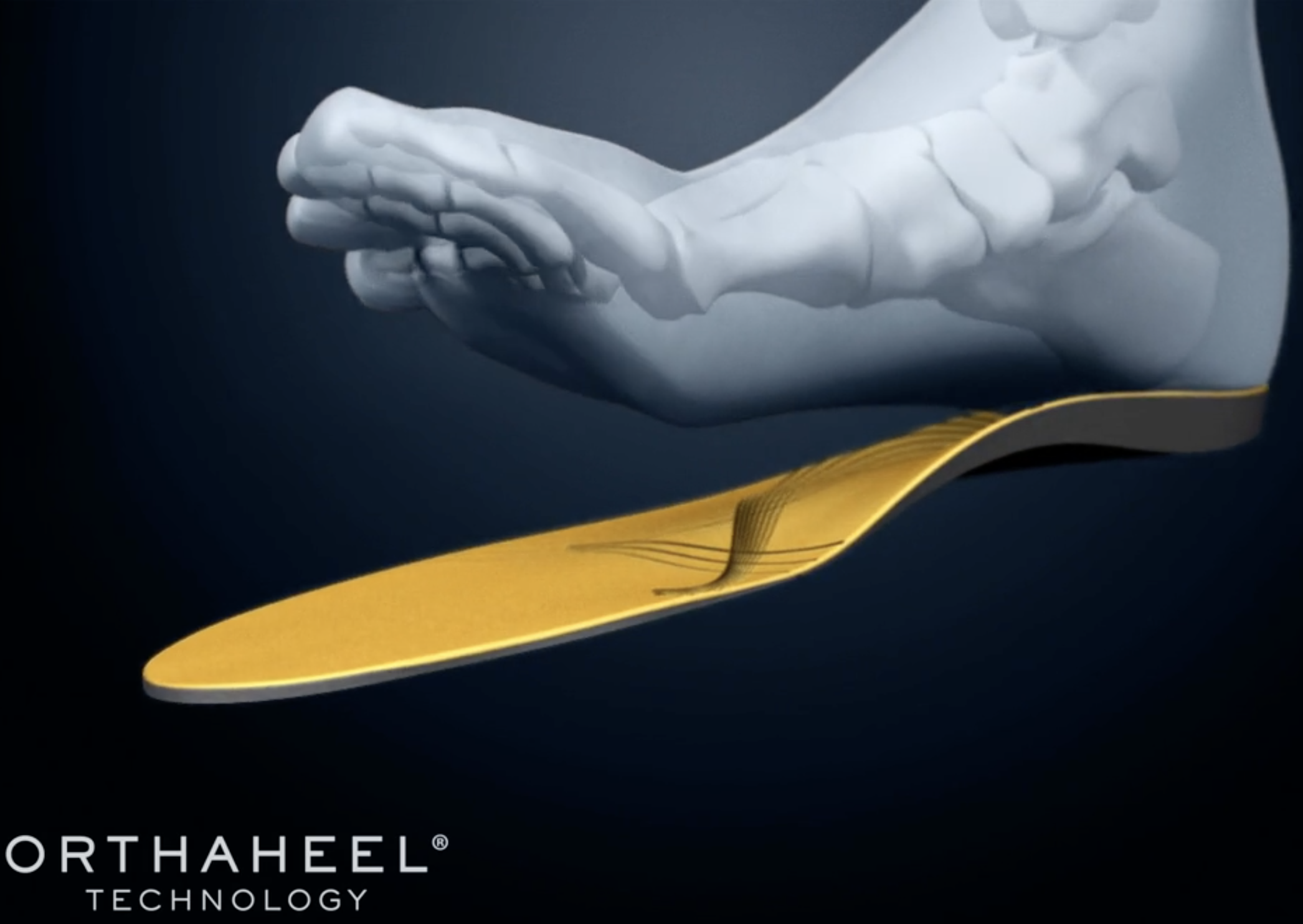 VIONIC ORTHOTIC